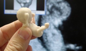 3D Fetus