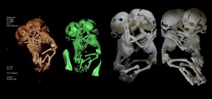 3D Fetus